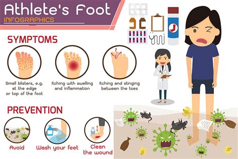 How To Get Rid Of Athletes Foot Quick Relief Tips Sports Management