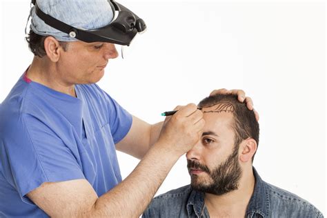 Hair Transplants The Difference Between FUE And FUT Procedures In Hair