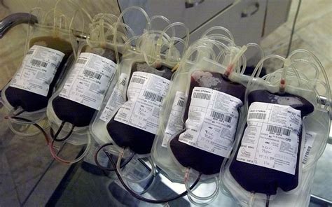 Blood Transfusions From Women Who Have Been Pregnant May Be Lethal To