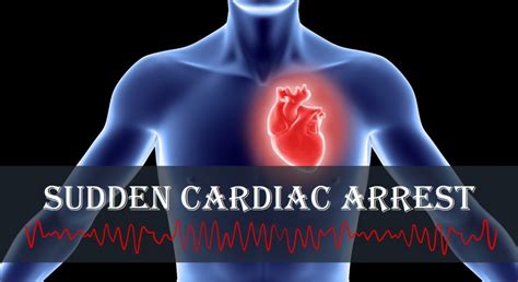Sudden Cardiac Arrest What Is It And What Can You Do About It Myheart