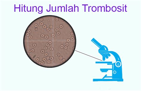 Hitung Jumlah Trombosit Metode Pipet Indonesian Medical Laboratory