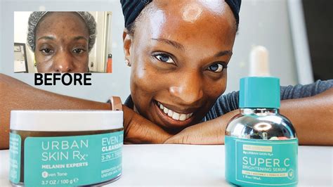 How I Cleared My Acne Bumps And Scars With Urban Skin Rx Morning