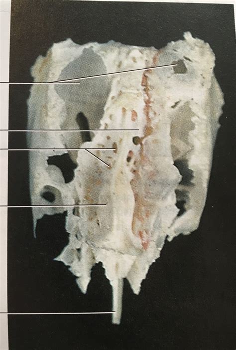 Ethmoid Bone Superior View Real Diagram Quizlet