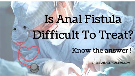 Urologist To Treat Anal Fistula Archives Laser Gastroenterology Clinic