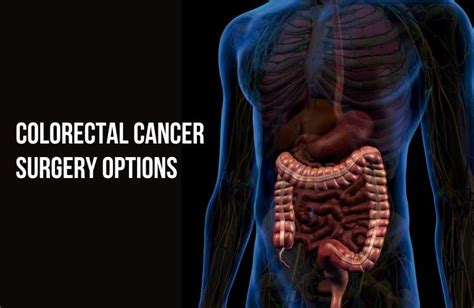 Surgical Options For Colorectal Cancer What To Expect Before During And After Surgery