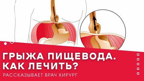 Грыжа пищевода диета питание Грыжа пищевода. Как лечить? - YouTube Грыжа пищевода. Как лечить? - YouTube Грыжа пищевода диета питание
