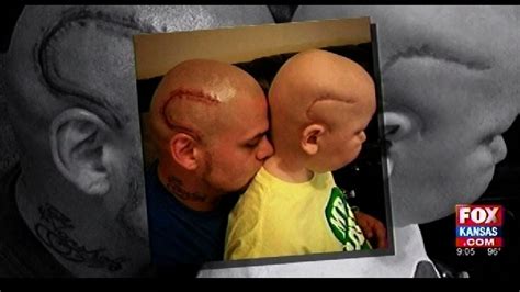Kansas Dad Gets Tattoo Matching Sons Surgical Scar Ksas