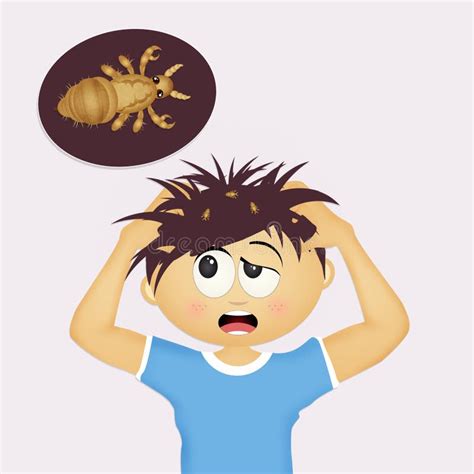 Child With Head Lice Stock Illustration Illustration Of Cute 78285259