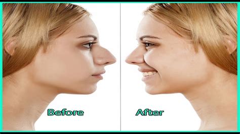 How To Get A Smaller Nose With Toothpaste Change Comin