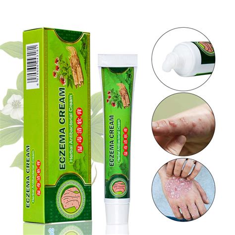 Buy Natural Al Cream Eczema Psoriasis Dermatitis Ointment Al Cream