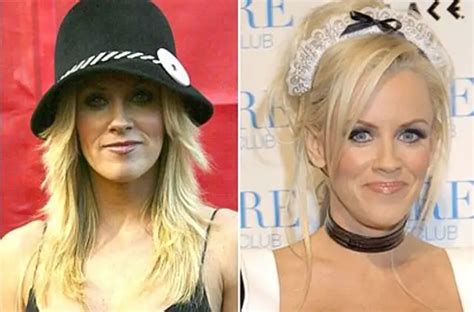 Jenny McCarthy Plastic Surgery Before And After Botox Injections Celebie