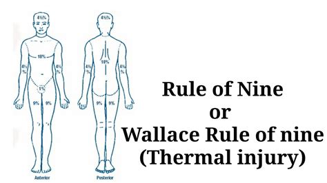 Rule Of Nine Wallace Rule Of Nine Thermal Injury Youtube