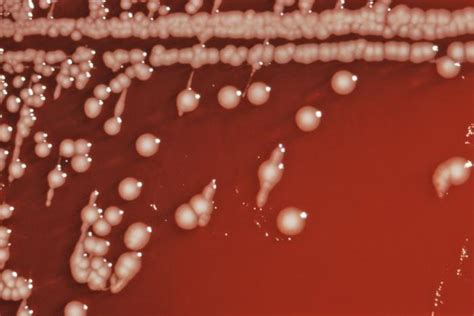 Control of salmonella enteritidis and salmonella gallinarum in birds by using live vaccine candidate containing attenuated salmonella gallinarum mutant strain. Salmonella and Salmonellosis