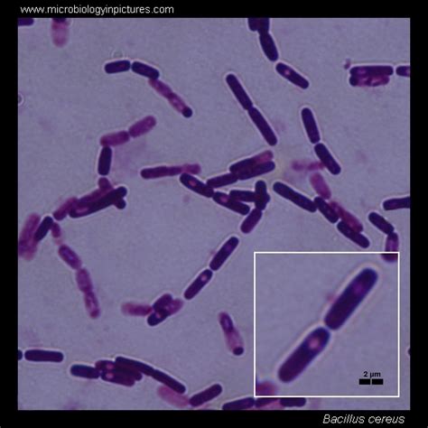 Bacillus Cereus CaracterÍsticas Gerais