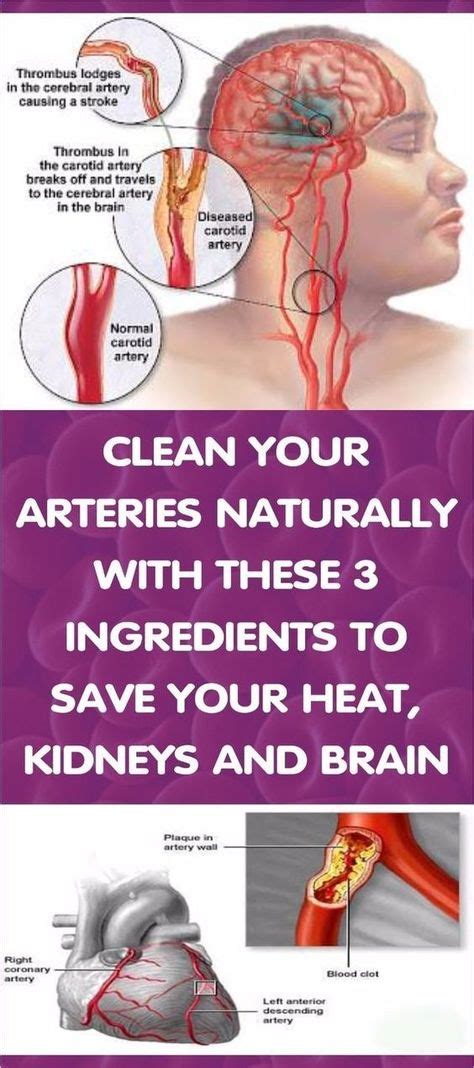 how to clean out plaque in arteries 3 ingredients mixture arteries health health remedies