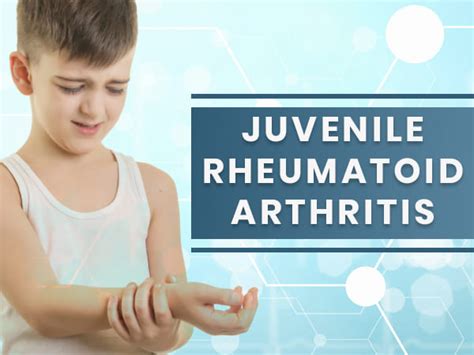 Juvenile Rheumatoid Idiopathic Arthritis Causes Symptoms Diagnosis