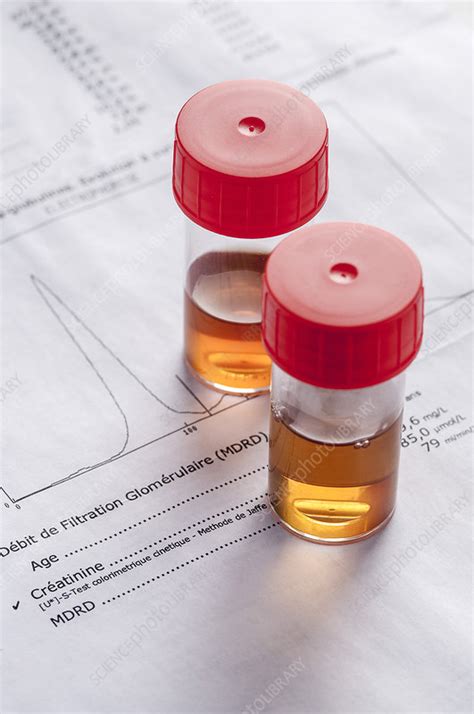 Urine Test Stock Image C0254225 Science Photo Library