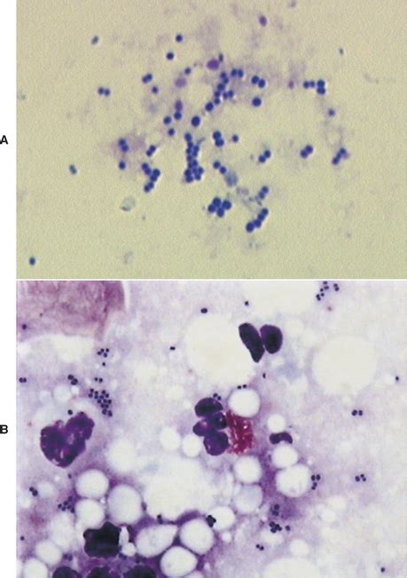 Cytology And Histopathology Of The Ear In Health And Disease Veterian Key