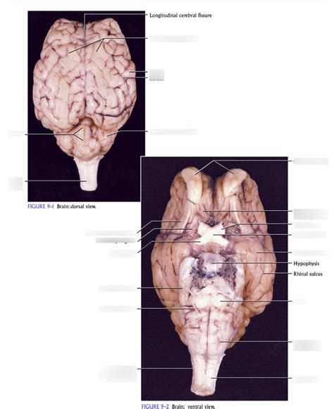 Dorsal And Ventral Brain Diagram Quizlet