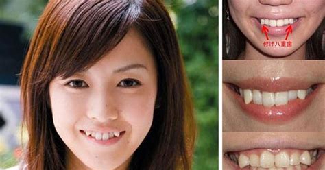 Unik Asiik Yaeba Tren Gigi Berantakan Dari Jepang
