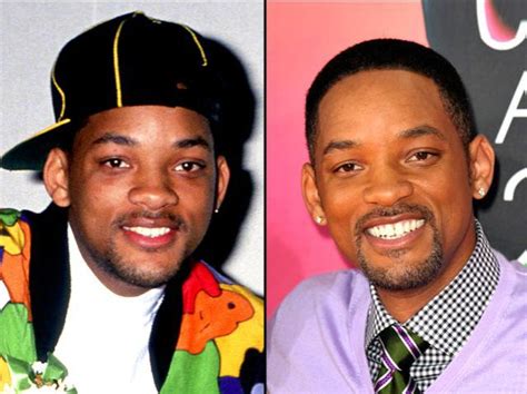 Will Smith Plastic Surgery