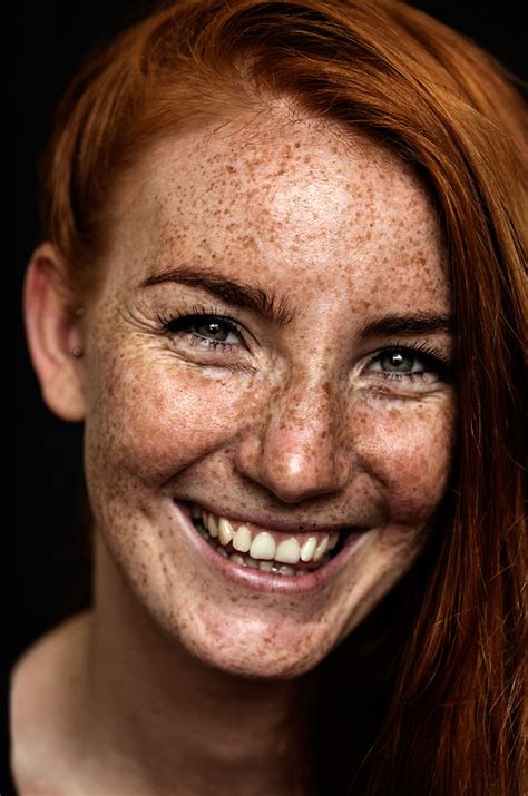 98 Freckled People Who Ll Hypnotize You With Their Unique Beauty Bored Panda