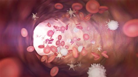 immune thrombocytopenic purpura onmedica