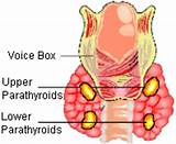 Mayo Clinic Parathyroid Surgery Pictures