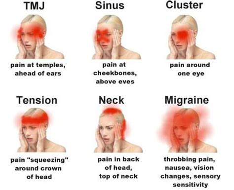 What is your headache telling you most important warning signs Tipos de dor de cabeça Dor