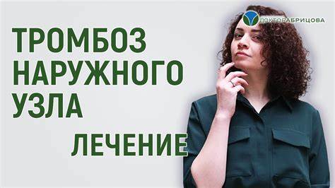 Тромбоз геморроидального узла диета
