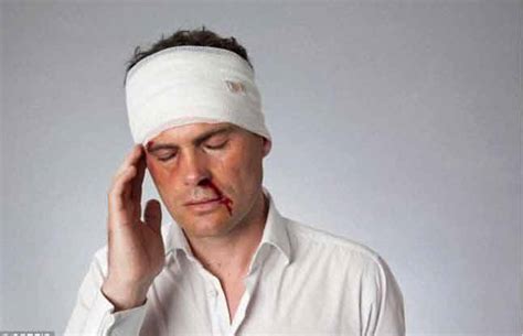 Head Injuries Archives Homeopathy At