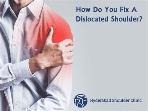 How Is A Dislocated Shoulder Fixed Shoulder Clinic Hyderabad