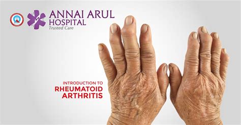 Introduction To Rheumatoid Arthritis Multispeciality Hospitals In Chennai