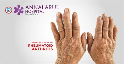 introduction to rheumatoid arthritis multispeciality hospitals in chennai