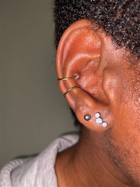 Infected Conch Rpiercingadvice