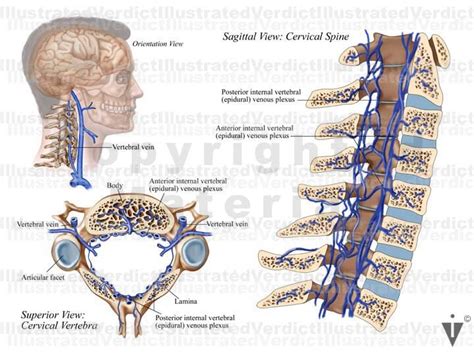 Stock Spine Cervical Spine — Illustrated Verdict