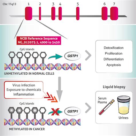 Gstp1 Methylation In Cancer A Liquid Biopsy Biomarker