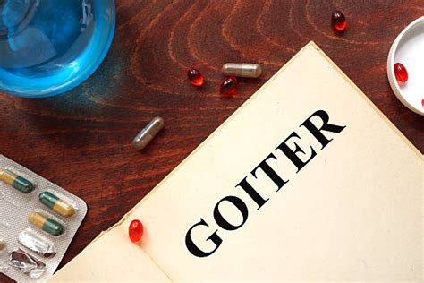 How To Treat Goiter With And Without Surgery Wound Care Society