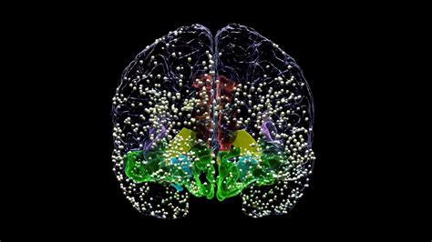 Personalized Brain Stimulation Alleviates Severe Depression Symptoms