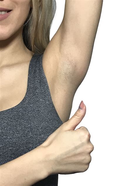 Now you know how you can lighten dark armpits fast. How To Lighten Your Dark Underarms Quickly & Instantly