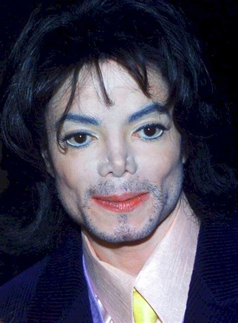 Estas Fotografías Mostrando La Transformación De La Cara De Michael