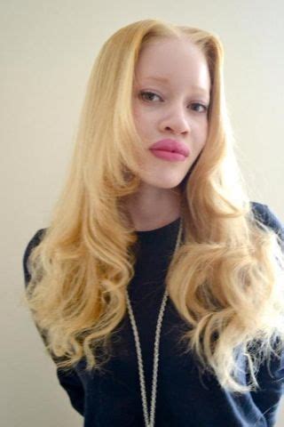 1000 Ideas About Albino African On Pinterest Albino Model Albinism