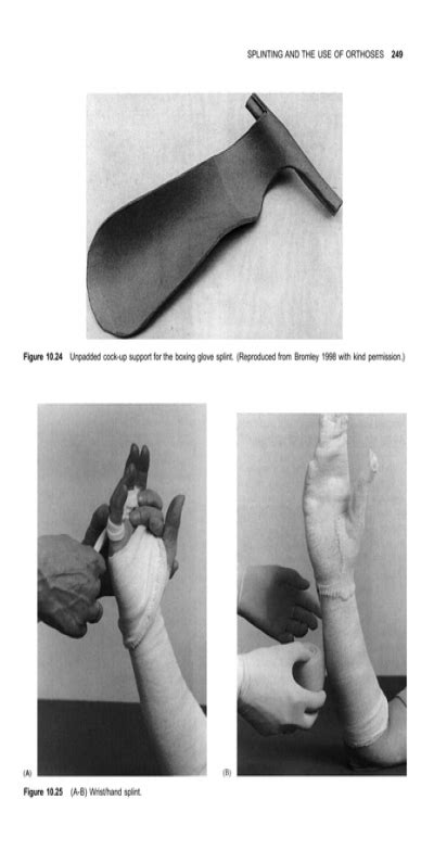Splinting And The Use Of