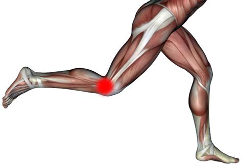 Iliotibial Band Syndrome Fascia And Fitness