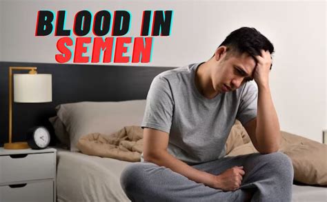 Blood In Semen Explore The Causes Symptoms And Treatment Flickr