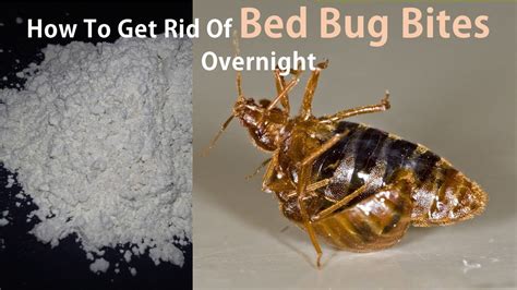 How To Treat Bed Bug Bites How To Get Rid Of Bed Bug Bites Overnight