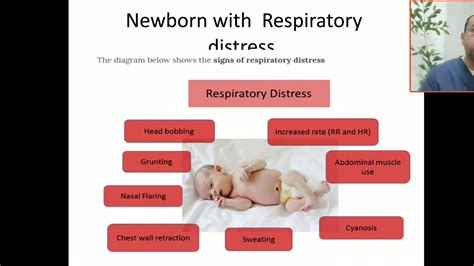 Case 27 How To Differentiate Between Rds And Neonatal Pneumonia Youtube