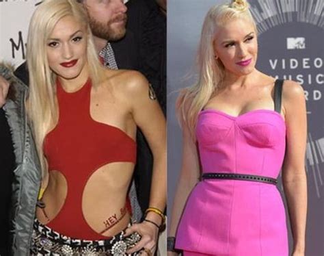 Gwen Stefani Before And After Plastic Surgery Celebrity Plastic Surgery Online