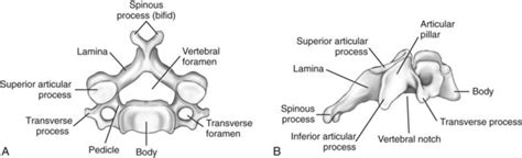 Typical Cervical Vertebrae Drawing Rwanda 24