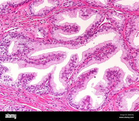 High Magnification Of A Human Prostatic Gland A Simple Columnar